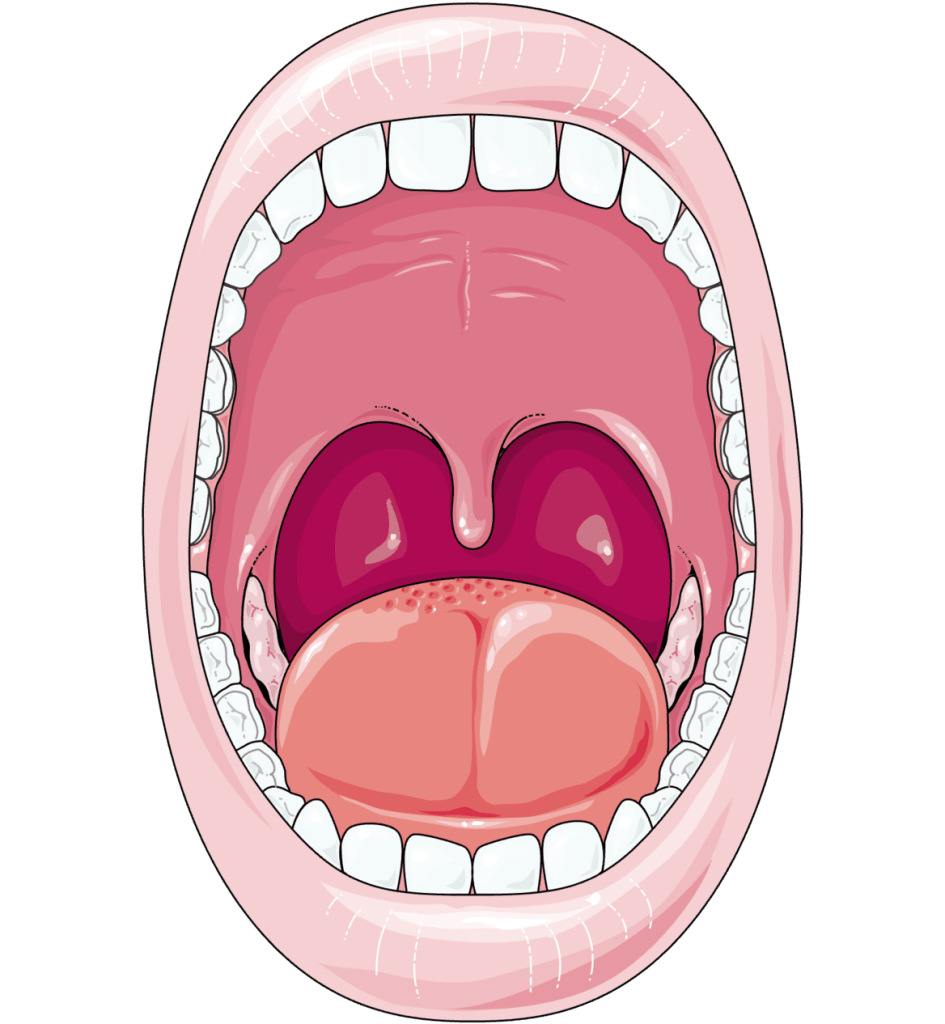 Oral lichen planus project home educational image