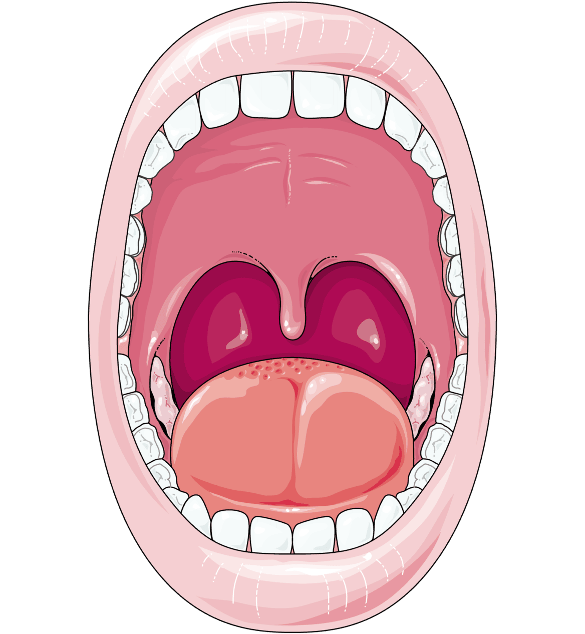 Oral lichen planus project home educational image